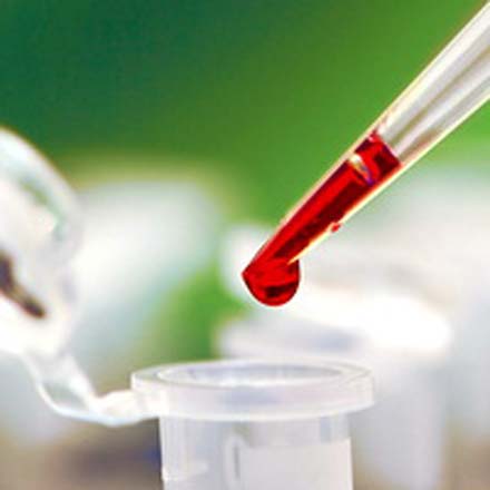 56 children get HIV, hepatitis after blood transfusion in western India