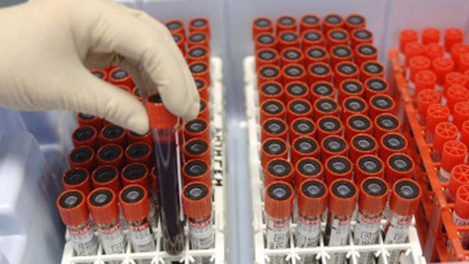 Israel to get swine flu vaccine