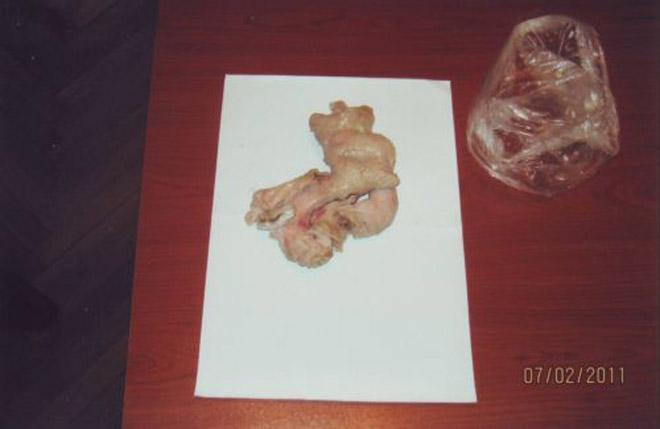 Azerbaijan prevents attempt to smuggle drugs into prison (PHOTO)