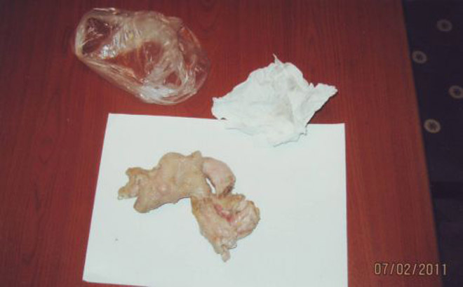 Azerbaijan prevents attempt to smuggle drugs into prison (PHOTO)