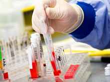 Lack of equipment supplies at Iran's medical labs - at critical level