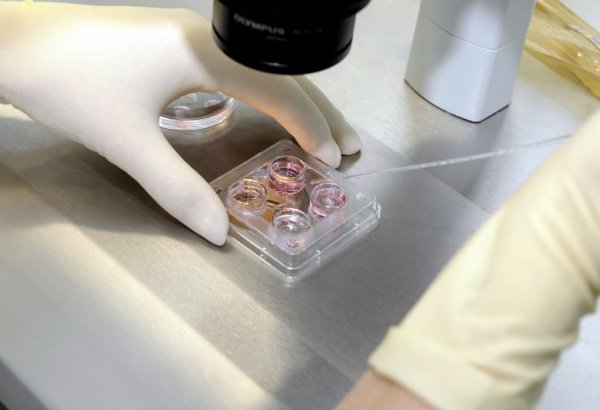 Anthrax virus spreads in Tajikistan
