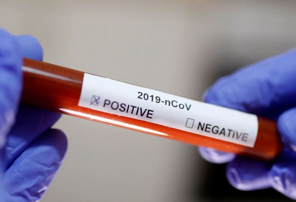 Senegal's confirmed COVID-19 cases rise to 222, 82 cured