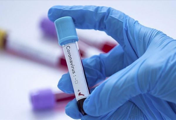 First death from novel coronavirus registered in Guatemala