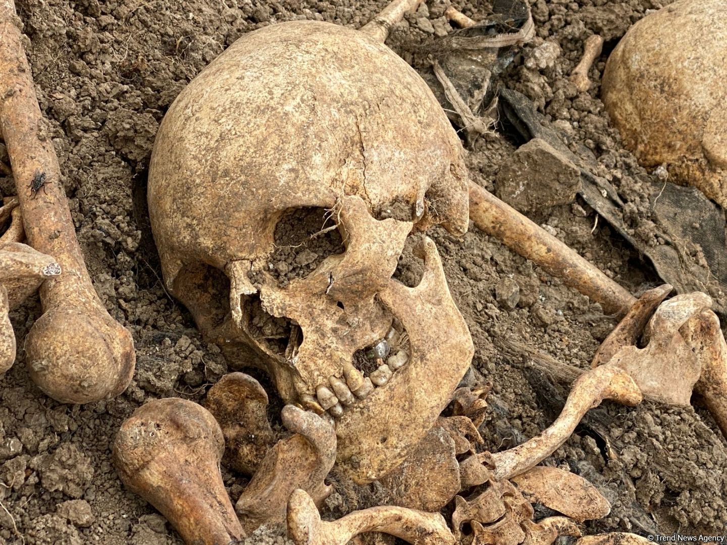 Another mass grave discovered in Azerbaijan's Khojavand (PHOTO)